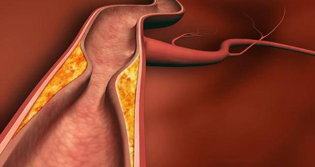 blood vessels