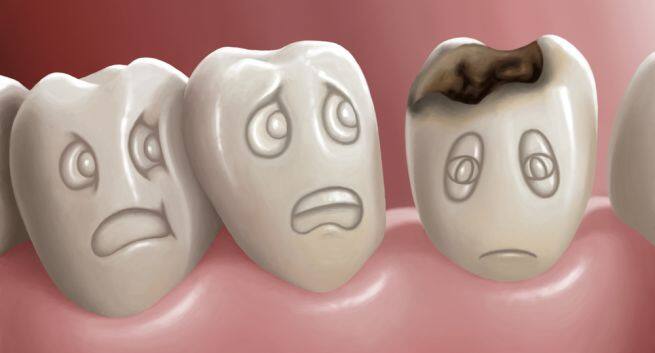 tooth cavity-aloe vera remedy