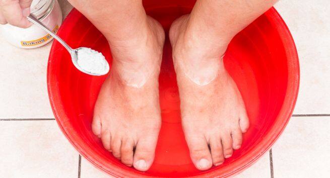 Calluses