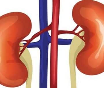 misshapen kidneys