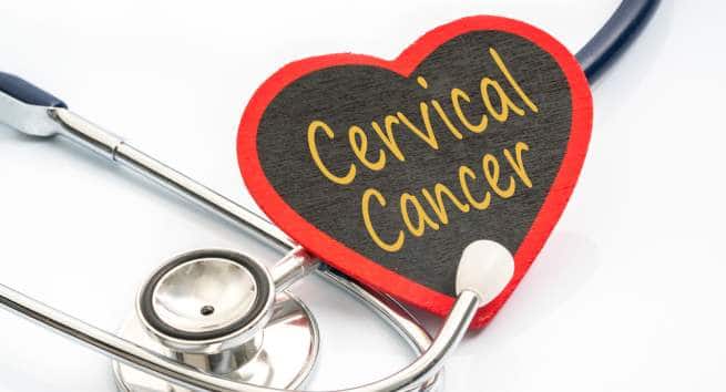 Cervical cancer