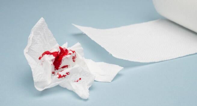 Bleeding post-sex