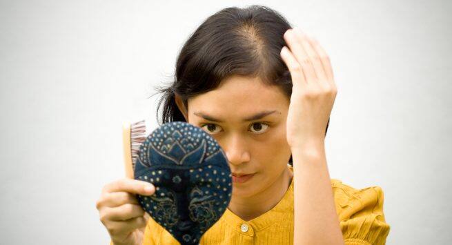 hair loss