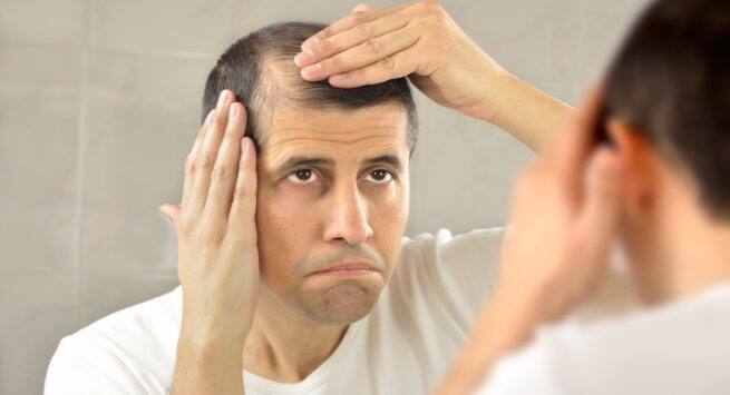 thinning hair