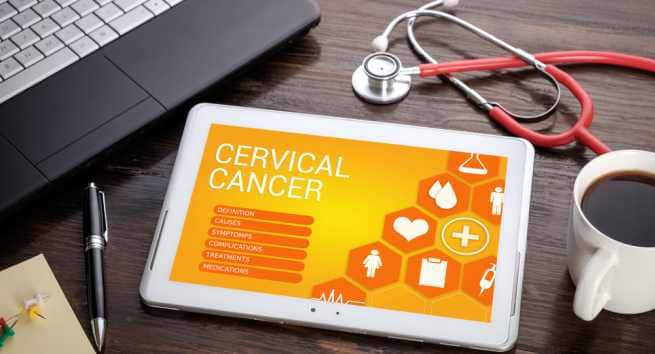 Risk factors of cervical cancer