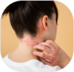 Skin Diseases
