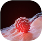 Tumors & Cancers