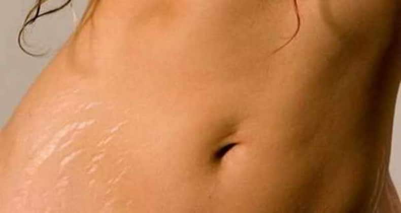 Gallery: 7 beauty benefits of olive oil for your hair and skin