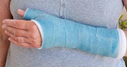 Got a bone fracture? It can lead to body pain later