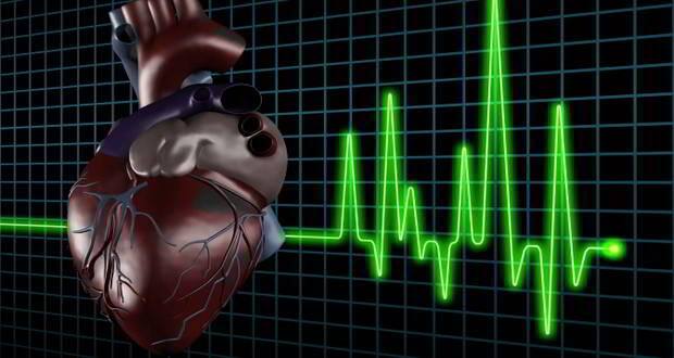 Heart attack
