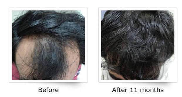 Dr Batras Nutri Good Hair Treatment, 500 gm
