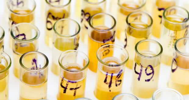 Urine test