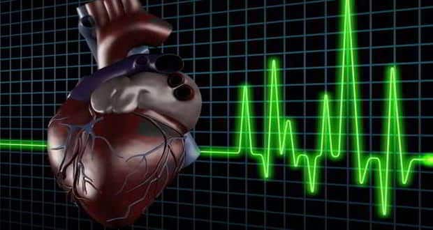 Heart attack