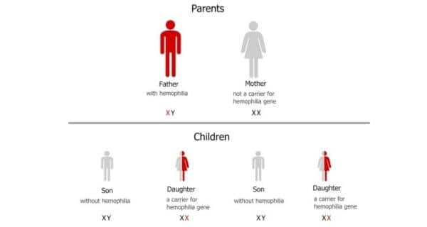 Hemophilia 1