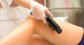 Expert answers to all your queries on laser hair reduction for getting rid of unwanted hair