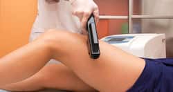 Can laser treatments help treat stretch marks post-pregnancy?