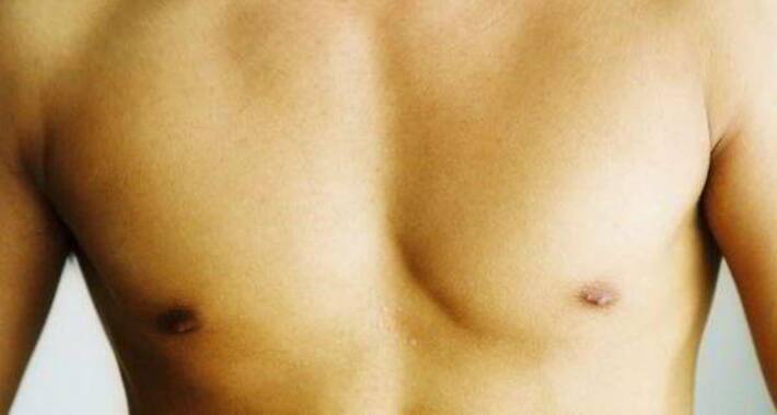 How to get rid of moobs or 'man boobs' and tone your chest ...