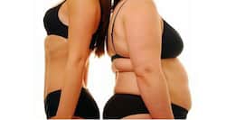 Laser Liposuction or Submental Liposuction: Should you go for it?