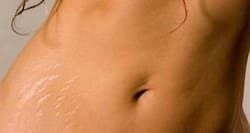 Lighten stretch marks with 6 DIY home remedies
