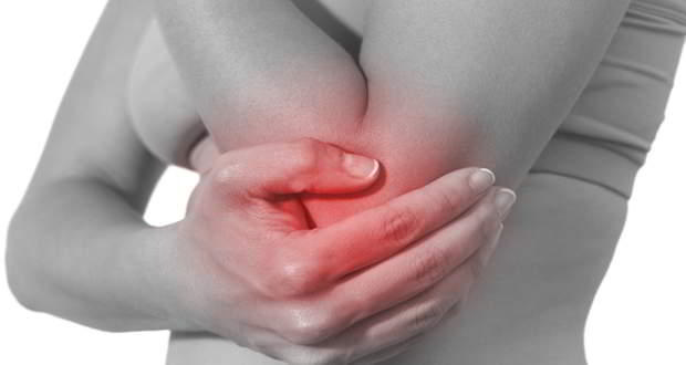 Arthritis