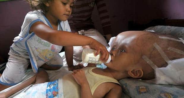 Dilla Anargia Adilla