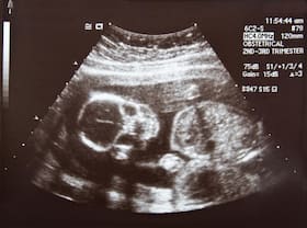 Scientists map all genes that govern early embryonic development Scientists map all genes that govern early embryonic development