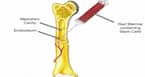 Over 1500 patients underwent successful Bone Marrow Transplants (BMT)