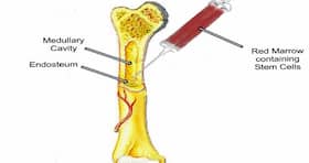 Over 1500 patients underwent successful Bone Marrow Transplants (BMT)