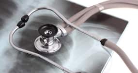 World TB Day - 10 facts about tuberculosis (TB) you should know