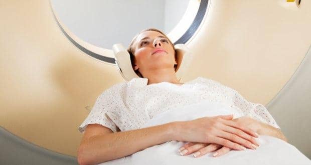 ovarian cancer image
