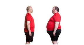 Does bariatric surgery help you lose weight? (Expert Speak)
