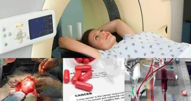 Cancer treatment