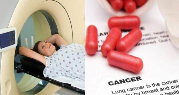 Lung cancer