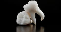 Tooth loss in elderly linked to malnutrition, finds study