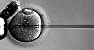 Intracytoplasmic sperm injection