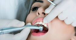 How tiny bubbles help your dentist clean your teeth