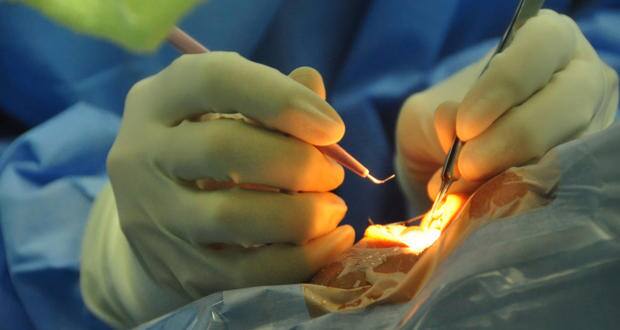 eye surgery