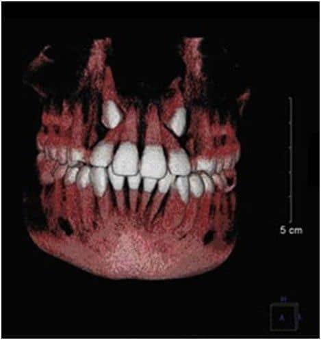 3D imaging