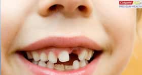 Dealing with tooth decay in children