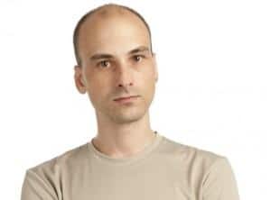 bald patch