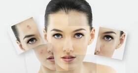 Home remedies for dark skin patches