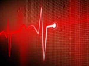 ECG