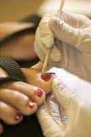 cuticle removal