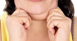 How do I get rid of my double chin?
