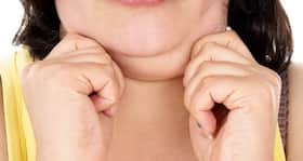 How do I get rid of my double chin?