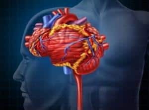 stroke
