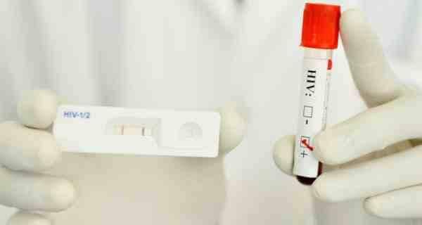 HIV diagnosis - everything you should know about | TheHealthSite.com