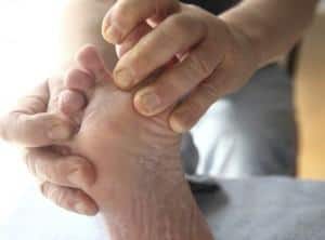 diabetic neuropathy