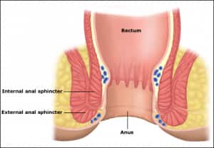 Anal spinchter