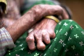 Leprosy : कलंक नहीं, एक ऐसी बीमारी है जिसका इलाज संभव है!